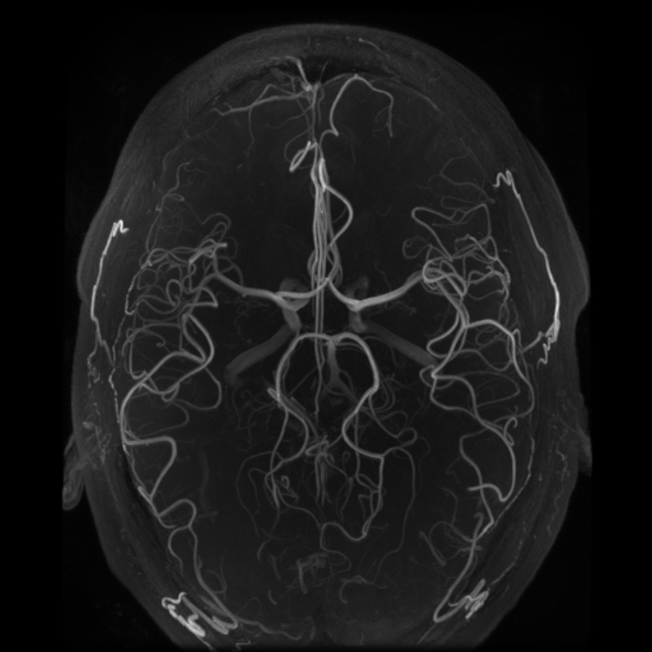 7.0T GE 950 MRI Scanner Images | Magnetic Resonance Research